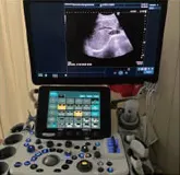 腹部エコー