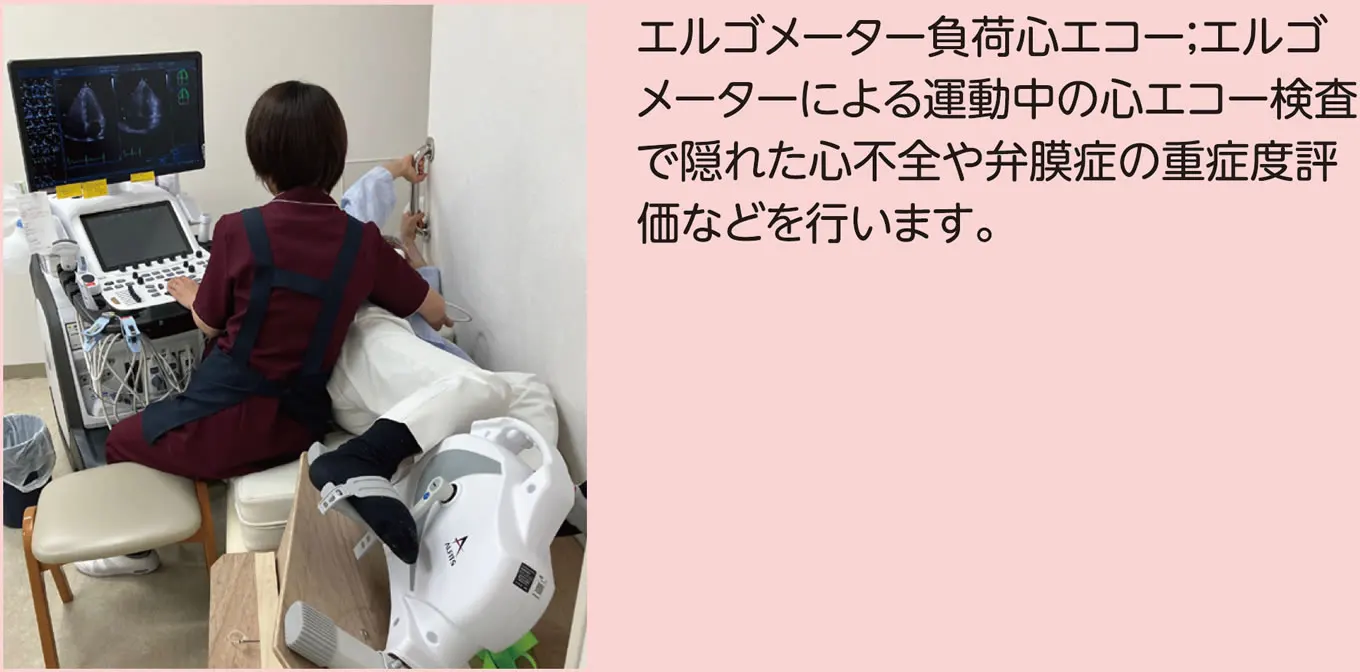 エルゴメーター負荷心エコー