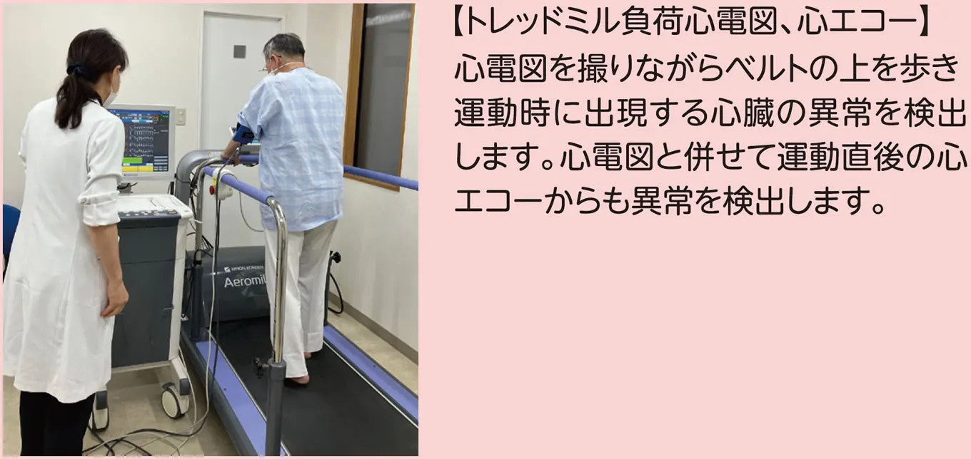 トレッドミル負荷心電図